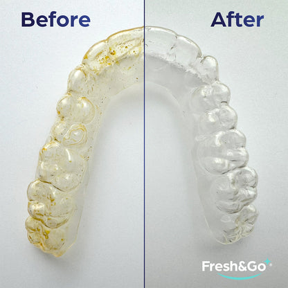 Fresh & Go Aligner and Retainer Cleaning Tablets 96's